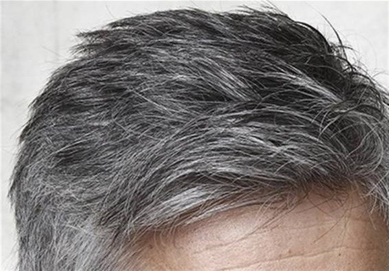 What is the cause of white hair?