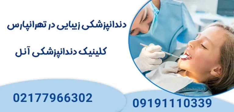 همه چیز درباره لمینت دندان و انتخاب بهترین خدمات لمینت در تهرانپارس