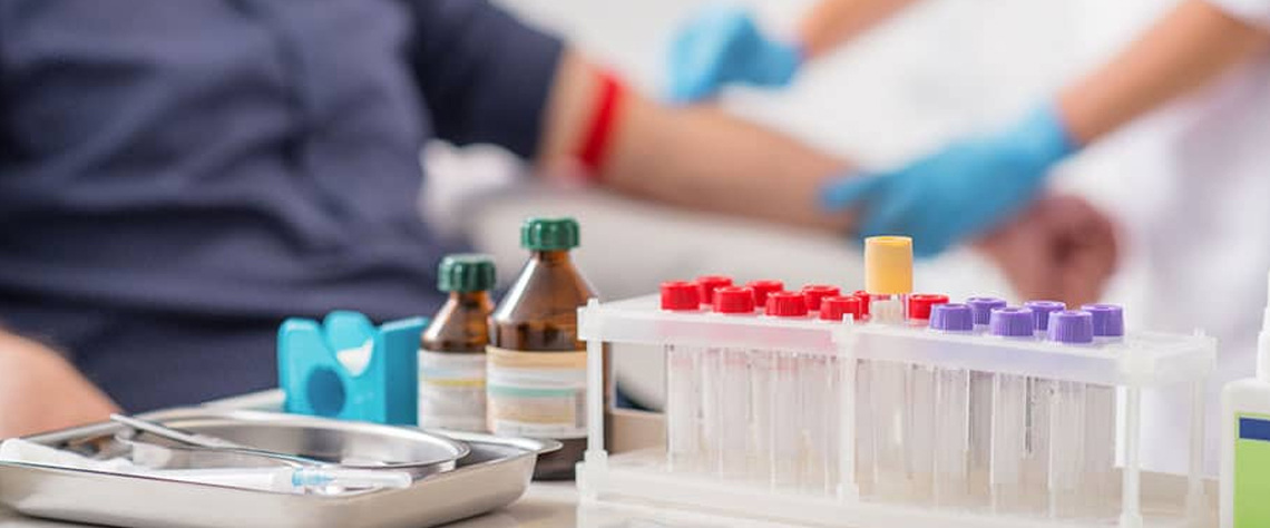 مراحل انجام چکاپ کامل خون در کلینیک‌ها